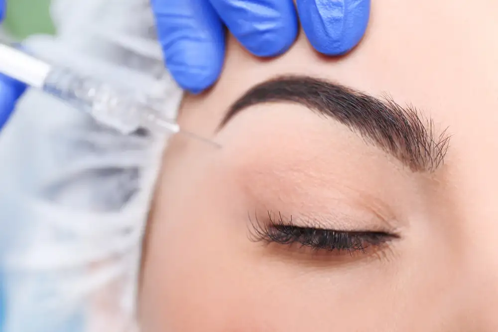 Brow Lift